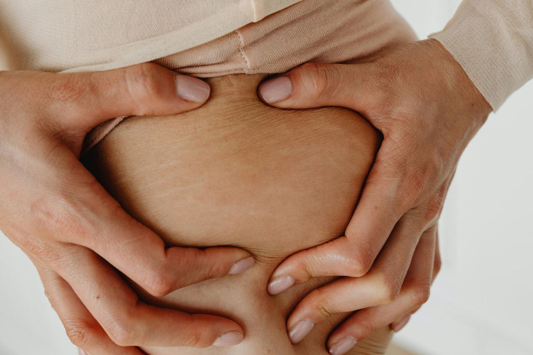 Panniculopatia, ovvero: la cellulite... conosciamola meglio